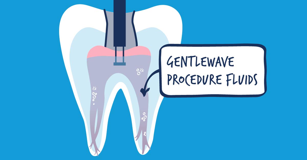 An Alternative to Standard Root Canal Treatment GentleWave Procedure